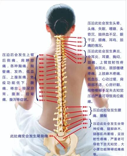 保護(hù)腰椎—示范腰椎保健操，趕快收藏吧