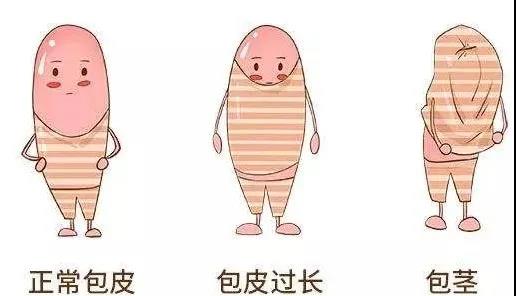 【保山安利醫(yī)院】家長速看！暑期包皮手術(shù)預(yù)約正當(dāng)時！