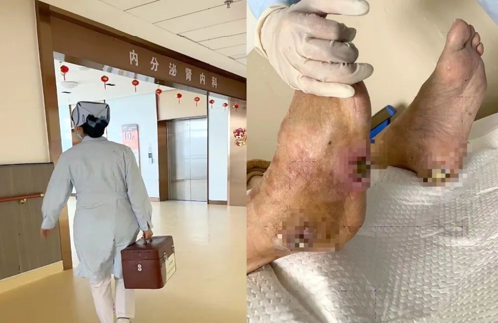 【保山安利醫(yī)院】傷口治療一站式，健康生活零距離！